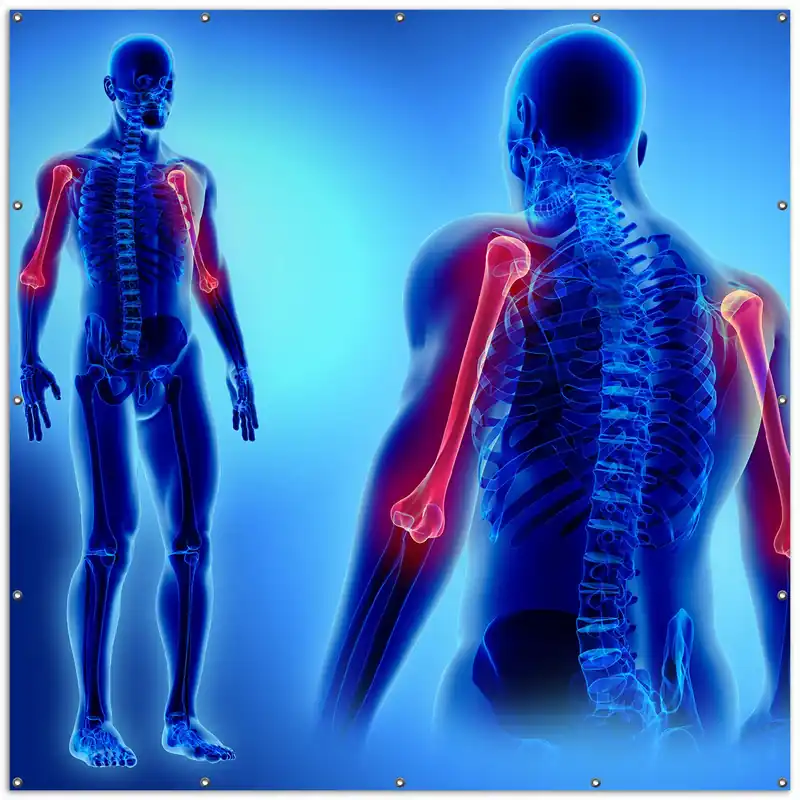 Gartenposter Anatomie Mensch Oberarmknochen 120 x 180 cm Versand Am Gleichen Tag